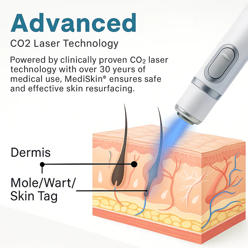 MediSkin Laser