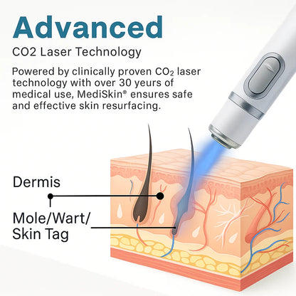 MediSkin Laser